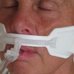 A woman with tube on her mouth