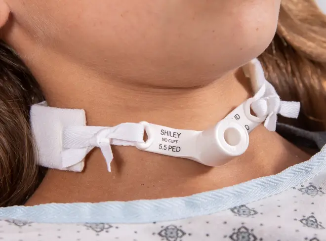 A patient with tube opening on her neck