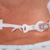 Adult one piece tracheostomy tube holder